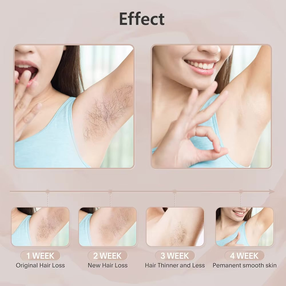 Permanent Laser Epilator Professional