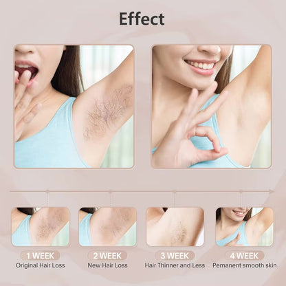 Permanent Laser Epilator Professional